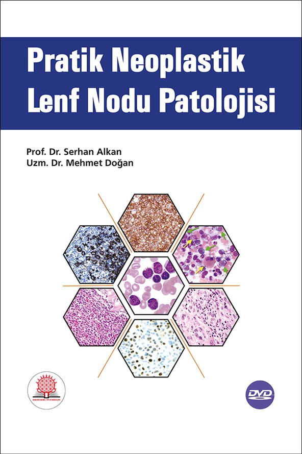 Pratik Neoplastik Lenf Nodu Patolojisi ürün görseli